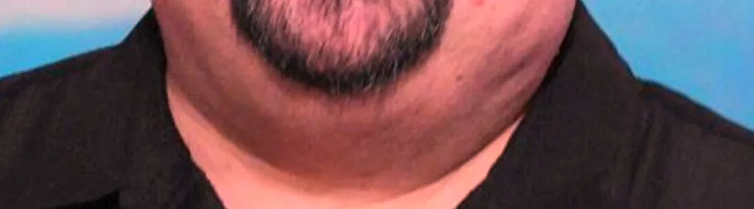 Gabriel Iglesias